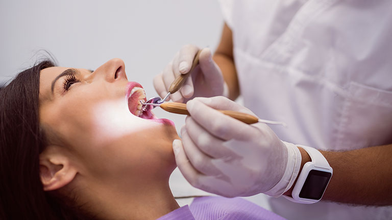 تصویر پر کردن دندان توسط یک دندانپزشک است